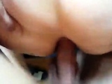 Anal 1